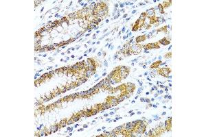 Immunohistochemistry (Paraffin-embedded Sections) (IHC (p)) image for anti-Leucine-Rich PPR-Motif Containing (LRPPRC) (AA 1041-1394) antibody (ABIN1680717)