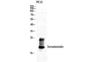 Western Blot (WB) analysis of specific cells using Somatostatin Polyclonal Antibody.