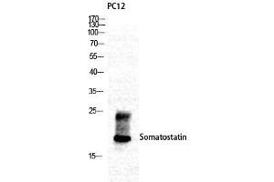 Western Blot (WB) analysis of specific cells using Somatostatin Polyclonal Antibody.