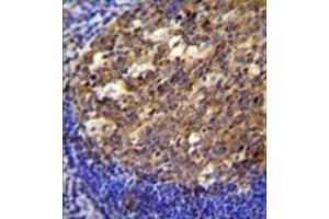 Immunohistochemistry (Paraffin-embedded Sections) (IHC (p)) image for anti-Twinfilin, Actin-Binding Protein, Homolog 2 (Drosophila) (TWF2) (AA 35-65), (N-Term) antibody (ABIN955401)