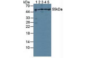 Figure. (PSMC1 Antikörper  (AA 1-440))