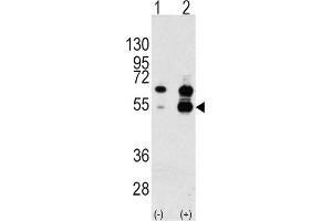 Western Blotting (WB) image for anti-PDGF and VEGF-Related Factor 1 (PVF1) antibody (ABIN3002600)