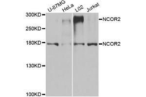 Western blot analysis of extracts of various cell lines, using NCOR2 antibody. (NCOR2 Antikörper)