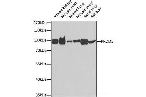 Western blot analysis of extracts of various cell lines using PRDM5 Polyclonal Antibody at dilution of 1:1000. (PRDM5 Antikörper)