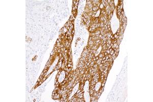 Immunohistochemistry (IHC) image for anti-Keratin 20 (KRT20) (AA 250-300) antibody (ABIN7453968) (Rekombinanter KRT20 Antikörper  (AA 250-300))