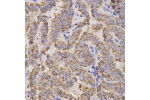 Immunohistochemistry (IHC) image for anti-Glycoprotein IX (Platelet) (GP9) antibody (ABIN1876562) (CD42a Antikörper)
