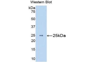 Western blot analysis of the recombinant protein. (Mannose Associated Serine Protease 2 (AA 22-142) Antikörper)