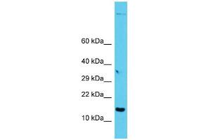 Host: Rabbit Target Name: GAGE12I Sample Type: PANC1 Whole Cell lysates Antibody Dilution: 1.
