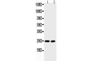 Anti-IL6 Picoband antibody,  All lanes: Anti-IL6 at 0. (IL-6 Antikörper  (AA 25-211))