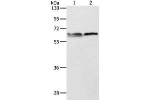 Western Blot analysis of 293T and Jurkat cell using ALAS2 Polyclonal Antibody at dilution of 1:1000 (ALAS2 Antikörper)