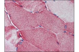 Immunohistochemistry Image: Human Skeletal Muscle: Formalin-Fixed, Paraffin-Embedded (FFPE)