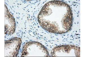 Immunohistochemical staining of paraffin-embedded Human liver tissue using anti-BSG mouse monoclonal antibody. (CD147 Antikörper)