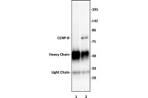 CENP-B antibody (pAb) tested by Immunoprecipitation.