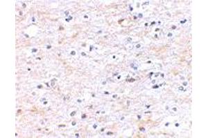 Immunohistochemical staining of human brain tissue using FNBP1L polyclonal antibody  at 2. (FNBP1L Antikörper  (N-Term))