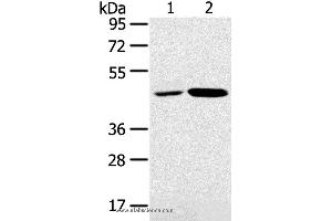 Western blot analysis of K562 and Jurkat cell, using SNX5 Polyclonal Antibody at dilution of 1:250 (SNX5 Antikörper)