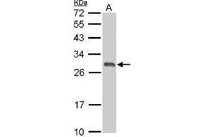 14-3-3 sigma/SFN Antikörper  (C-Term)