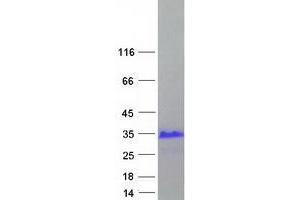 X Antigen Family, Member 3 (XAGE3) (Transcript Variant 1) protein (Myc-DYKDDDDK Tag)