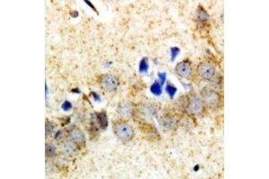 Immunohistochemical analysis of Carboxypeptidase A6 staining in rat brain  formalin fixed paraffin embedded tissue section.