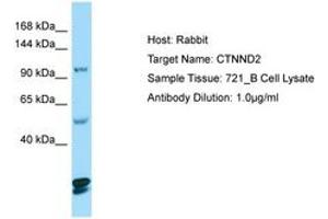 Image no. 1 for anti-Catenin (Cadherin-Associated Protein), delta 2 (Neural Plakophilin-Related Arm-Repeat Protein (CTNND2) (AA 1066-1115) antibody (ABIN6749992) (CTNND2 Antikörper  (AA 1066-1115))