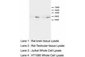 Image no. 1 for anti-High Mobility Group Box 4 (HMGB4) (N-Term) antibody (ABIN1495045)