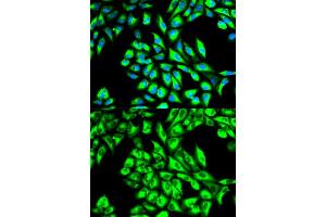 Immunofluorescence analysis of HeLa cells using EEF1A1 antibody. (eEF1A1 Antikörper)