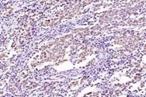 Immunohistochemistry (Paraffin-embedded Sections) (IHC (p)) image for anti-serum Response Factor Binding Protein 1 (SRFBP1) antibody (ABIN7075579)