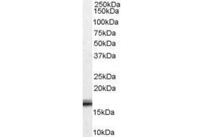 Western Blotting (WB) image for anti-Von Hippel-Lindau Tumor Suppressor, E3 Ubiquitin Protein Ligase (VHL) (Internal Region) antibody (ABIN185675)
