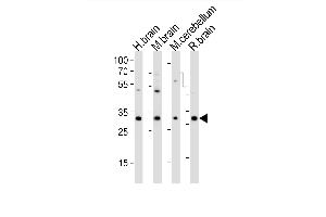 Western blot analysis of lysates from human brain, mouse brain, mouse cerebellum, rat brain tissue (from left to right), using PCGF1 Antibody (Center) (ABIN6242736 and ABIN6577728). (PCGF1 Antikörper  (AA 117-151))