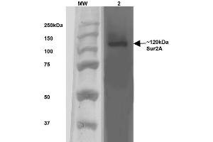 Western Blot analysis of Rat Brain Membrane showing detection of ~120 kDa SUR2A protein using Mouse Anti-SUR2A Monoclonal Antibody, Clone S319A-14 . (ABCC9 Antikörper  (AA 1505-1546) (HRP))