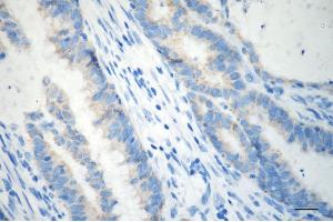 anti-Aldehyde Dehydrogenase 1 Family, Member B1 (ALDH1B1) antibody