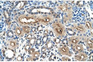 Immunohistochemistry (IHC) image for anti-C-Type Lectin Domain Family 4, Member M (CLEC4M) (N-Term) antibody (ABIN2775393)