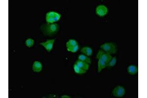 Immunofluorescent analysis of MCF-7 cells using ABIN7171717 at dilution of 1:100 and Alexa Fluor 488-congugated AffiniPure Goat Anti-Rabbit IgG(H+L)