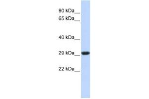 WB Suggested Anti-SDHB Antibody Titration:  0.