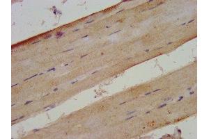 IHC image of ABIN7175925 diluted at 1:300 and staining in paraffin-embedded human skeletal muscle tissue performed on a Leica BondTM system. (XIRP2 Antikörper  (AA 2861-3004))