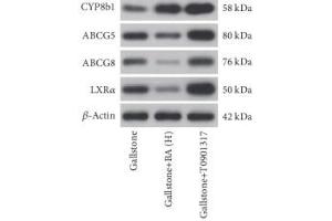 Western Blotting (WB) image for anti-ATP-Binding Cassette, Sub-Family G (WHITE), Member 8 (ABCG8) (AA 1-320) antibody (ABIN3022643)