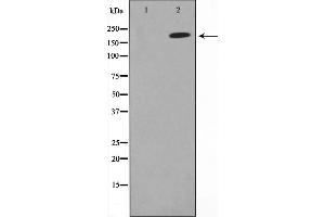 Western blot analysis on A549 cell lysate using MAGI2 Antibody,The lane on the left is treated with the antigen-specific peptide. (MAGI2 Antikörper  (N-Term))