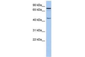 Image no. 1 for anti-Ring Finger Protein 169 (RNF169) (AA 215-264) antibody (ABIN6743184) (RNF169 Antikörper  (AA 215-264))