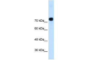 WB Suggested Anti-ACTN4  Antibody Titration: 0. (alpha Actinin 4 Antikörper  (N-Term))