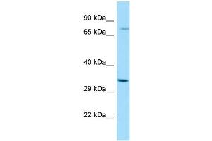 WB Suggested Anti-RASL11A Antibody Titration: 1. (RASL11A Antikörper  (N-Term))