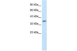 WB Suggested Anti-HEYL Antibody Titration: 1. (HEYL Antikörper  (N-Term))