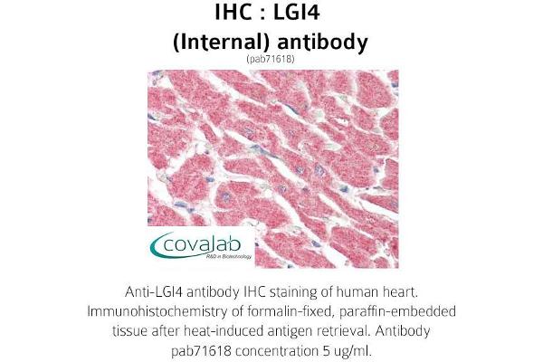 LGI4 anticorps  (Internal Region)