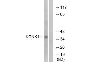 Western blot analysis of extracts from Jurkat cells, using KCNK1 antibody. (KCNK1 Antikörper  (C-Term))