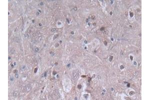 IHC-P analysis of Rat Spinal cord Tissue, with DAB staining. (PF4 Antikörper  (AA 30-105))