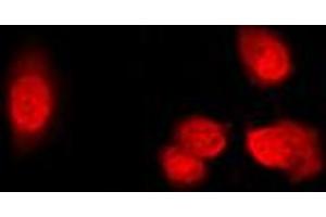 Immunofluorescent analysis of Histone Deacetylase 5 (pS498) staining in Raw264. (HDAC5 Antikörper  (pSer498))