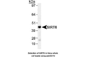 Image no. 1 for anti-Sirtuin 6 (SIRT6) (AA 300-355), (C-Term) antibody (ABIN363528) (SIRT6 Antikörper  (C-Term))
