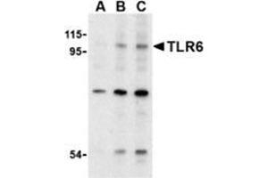 Western blot analysis of TLR6 in Jurkat cell lysate with TLAP30903PU-N at (A) 0. (TLR6 Antikörper  (N-Term))