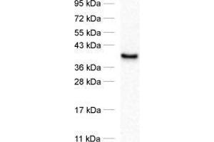 dilution: 1 : 1000, sample: synaptosomal fraction of rat brain (P2) (PTPLAD1 Antikörper)