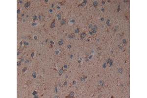 Used in DAB staining on fromalin fixed paraffin- embedded brain tissue (GABRA2 Antikörper  (AA 42-250))