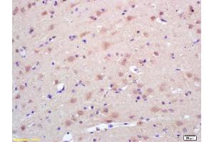 Formalin-fixed and paraffin embedded rat brain labeled with Rabbit Anti Trk A/B/C Polyclonal Antibody, Unconjugated (ABIN726095) at 1:200 followed by conjugation to the secondary antibody and DAB staining (TrkA, B, C (AA 668-750) Antikörper)
