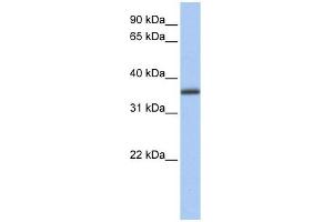 GALE antibody used at 1 ug/ml to detect target protein.